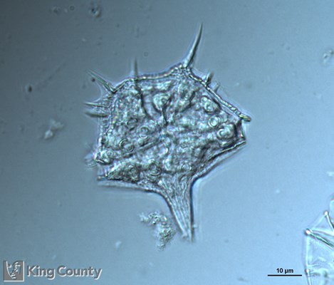 Photo of Amylax triacantha